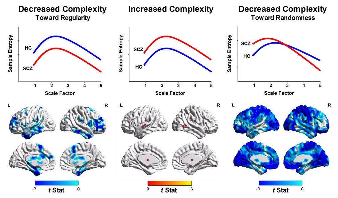 Complexity Analysis of Brain Signals