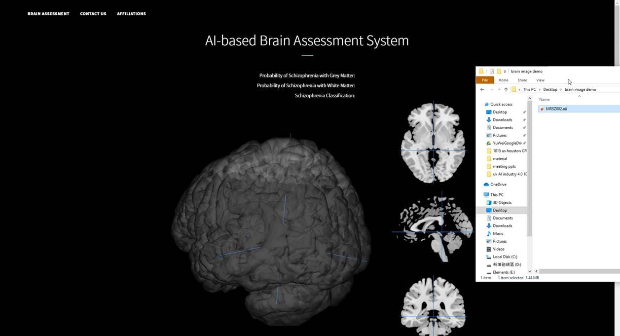Machine Learning in Psychiatry