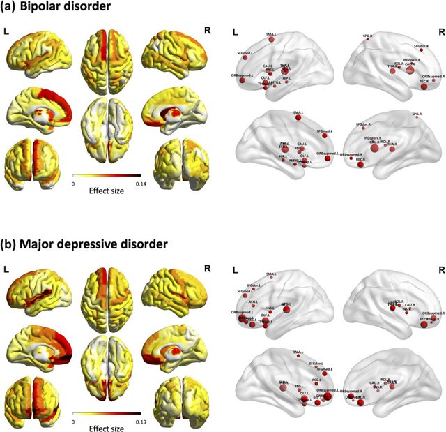 Figure 2 from “Identifying key brain pathology in bipolar and unipolar depression using a region-specific brain aging trajectories approach: Insights from the Taiwan Aging and Mental Illness Cohort”