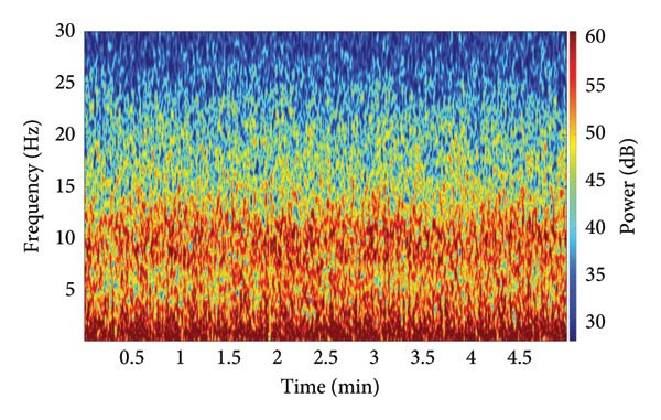 Figure 2 from “Exploring Nociceptive-Analgesic Balance and EEG Modulation Patterns During General Anesthesia Using Holo-Hilbert Spectral Analysis”